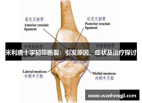 米利唐十字韧带断裂：引发原因、症状及治疗探讨